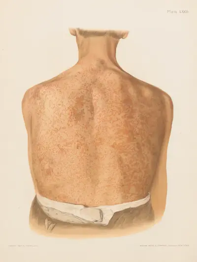 Chromophytosis av Prince Albert Morrow