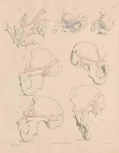 A peculiarity of one of the Pudic branches, Enlarged veins of the Prostate Gland and Urinary Bladder, Joseph Maclise