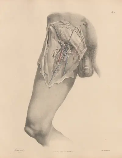 A view of the Femoral artery, with the veins, nerves, and fascia, Joseph Maclise
