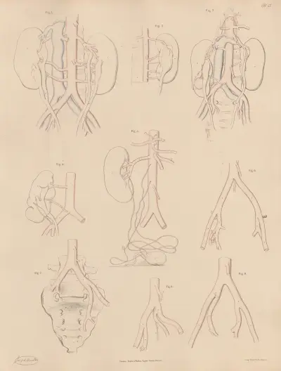 Peculiarities of some of the branches of the Abdominal Aorta, and of the Iliac arteries, Joseph Maclise