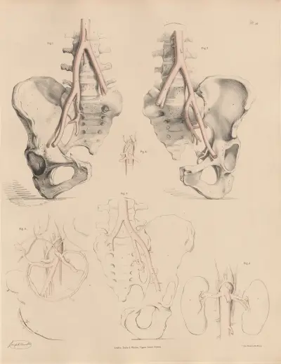 Peculiarities of the Abdominal Aorta, and of some of its branches, Joseph Maclise