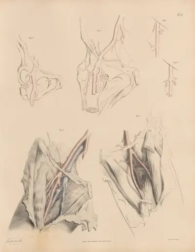 Peculiarities of the branches of the Deep Femoral, especially of the External Circumflex, Joseph Maclise