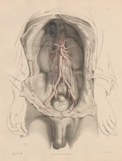 The Abdominal Aorta and the branches arising in its course. The Iliac arteries, Joseph Maclise