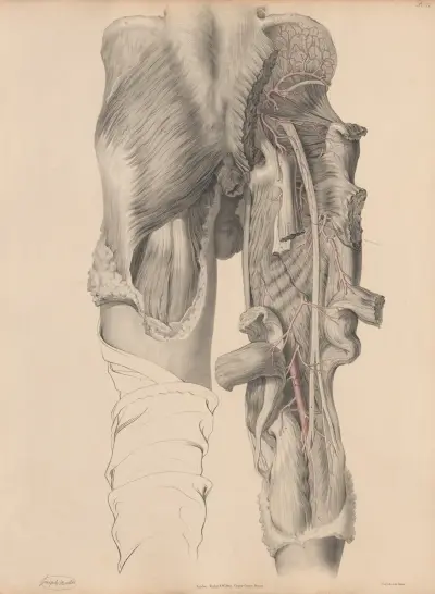 The Arteries on the Pelvis more completely exposed, Joseph Maclise
