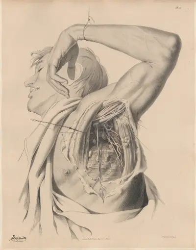 The Axilla, seen from below,—showing the Arteries, the Veins, the Nerves, and the Lymphatic glands, Joseph Maclise