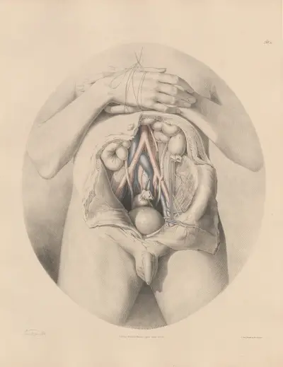 The Iliac arteries in connexion with the veins, Joseph Maclise