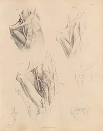 Various forms of the Deep Femoral artery, Joseph Maclise