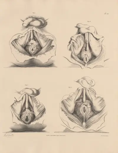 Various forms of the Pudic branches seen in the Perineum, Joseph Maclise