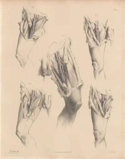 Various forms of the Veins connected with the Femoral artery, Joseph Maclise