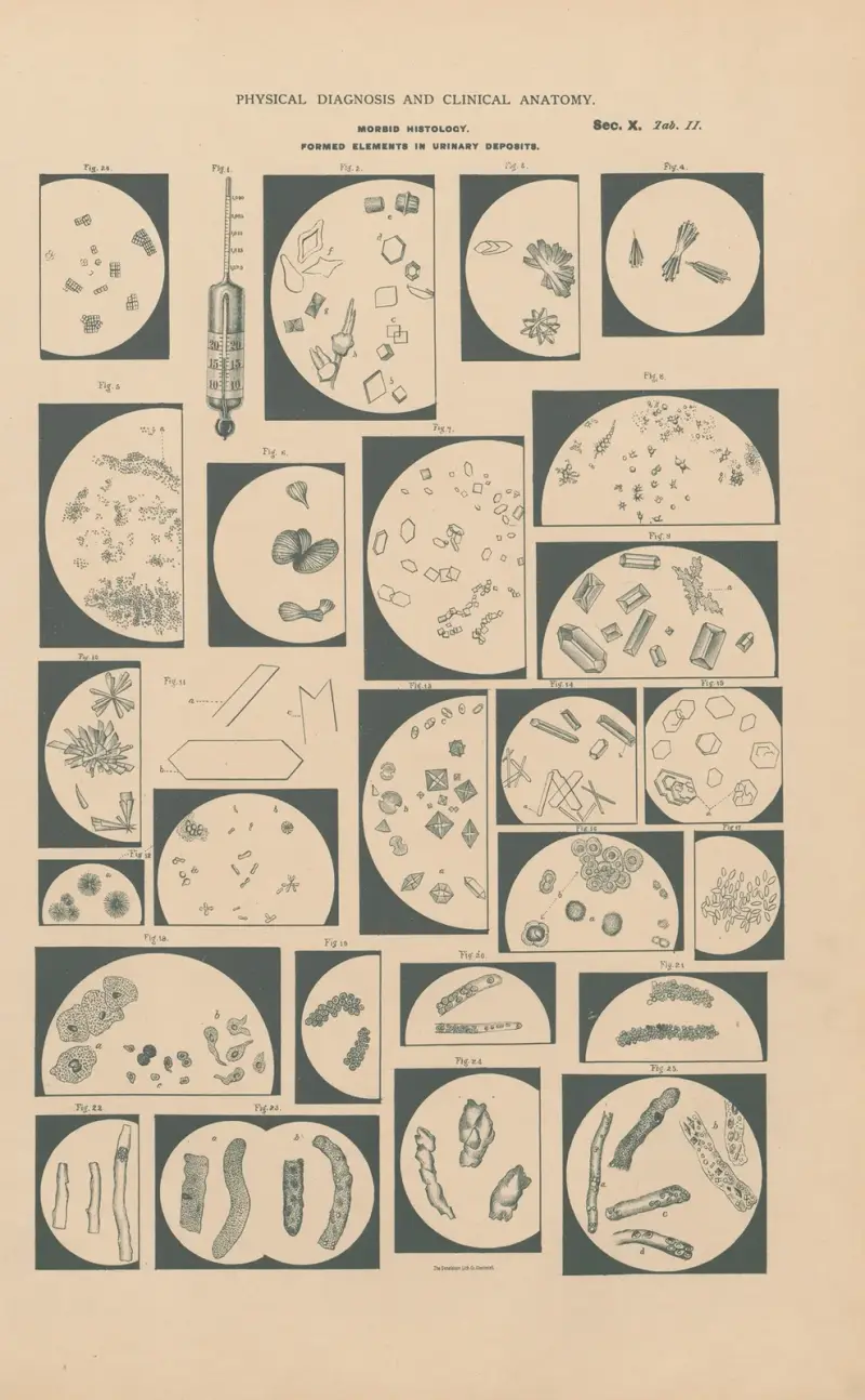 Morphological elements in urinary deposits av Jean Allard Jeancon