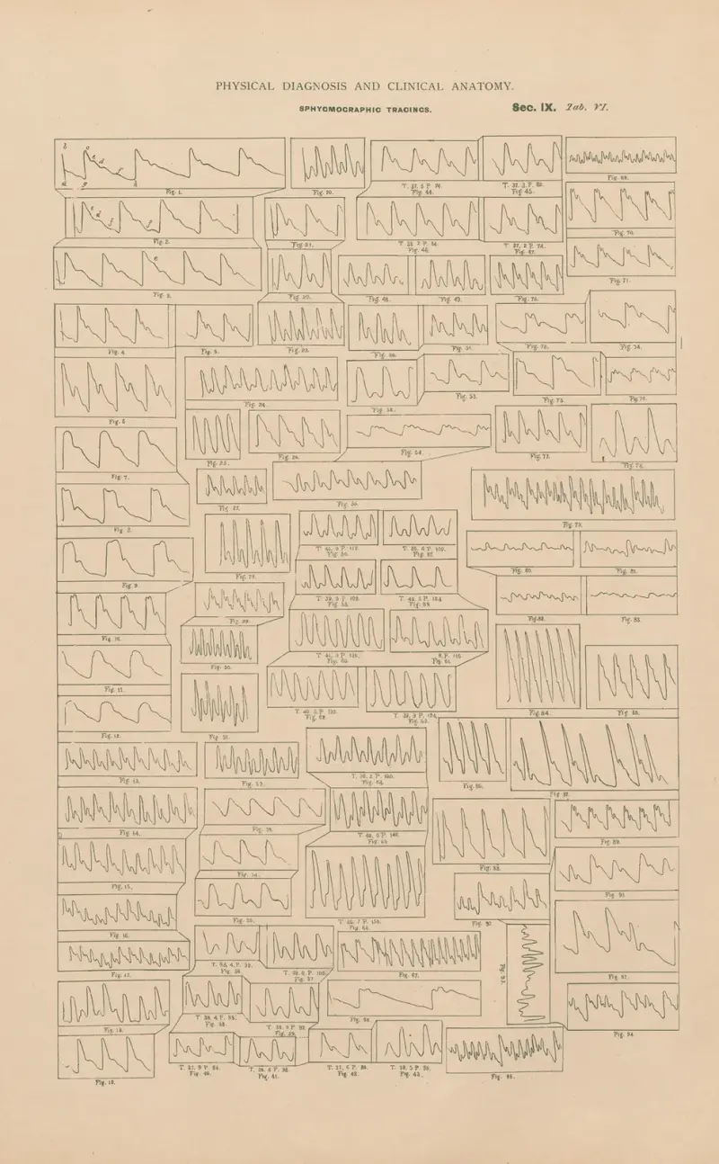 Sphygmographic tracings av Jean Allard Jeancon