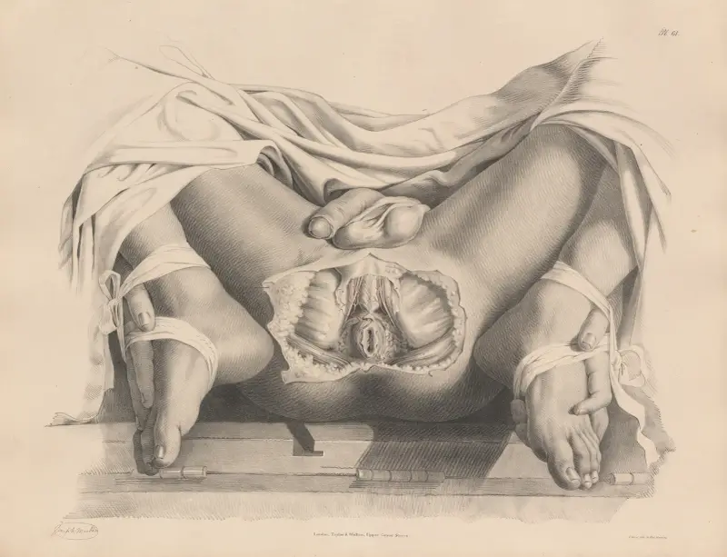 Widok tętnic i innych struktur widocznych w powierzchownej preparacji krocza, Joseph Maclise