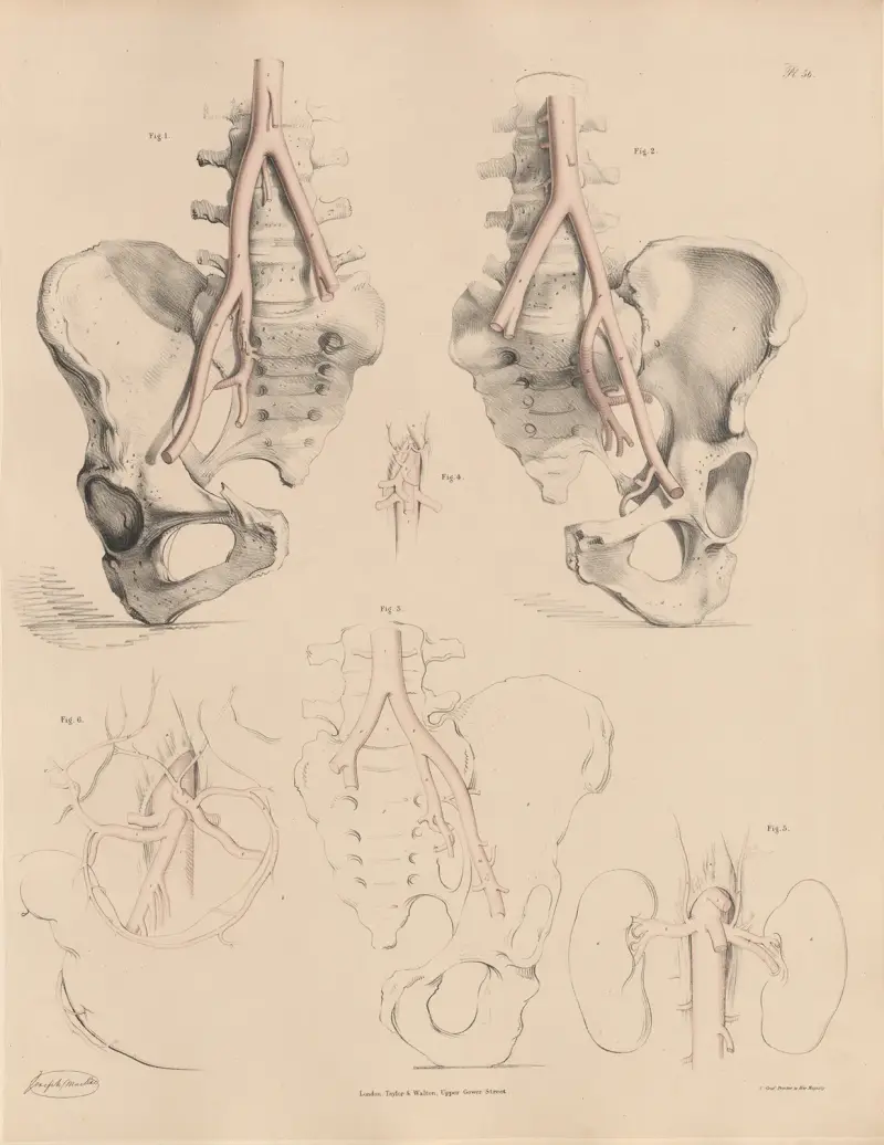 Egenheter hos bukaortan och några av dess grenar av Joseph Maclise