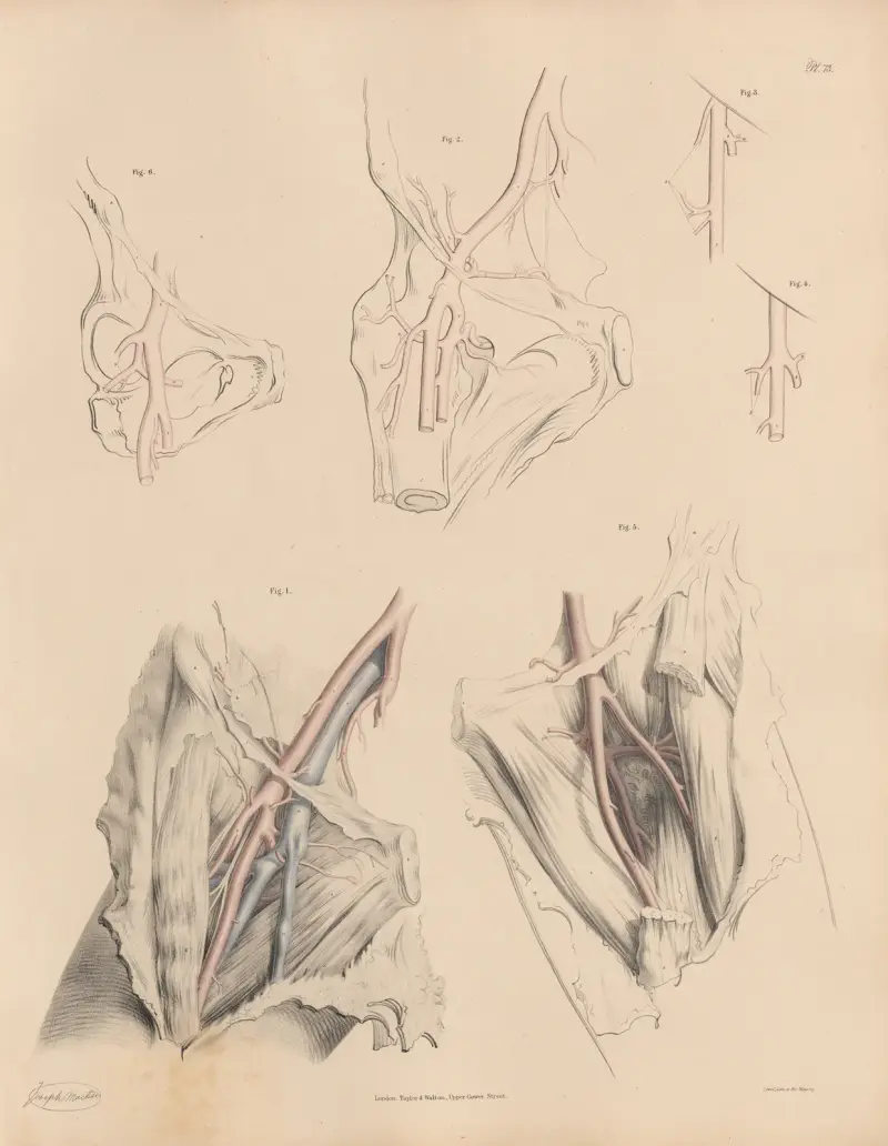 Egenheter hos grenarna av den djupa lårbensartären, särskilt den yttre omkretsartären av Joseph Maclise