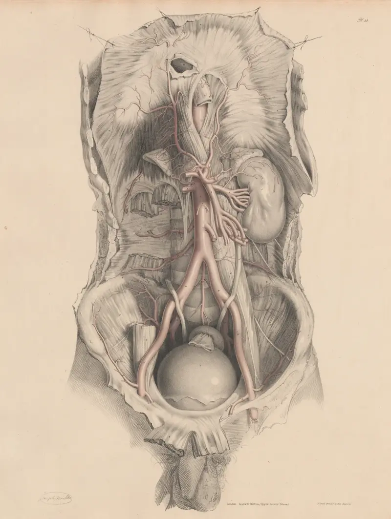 Břišní aorta, Joseph Maclise