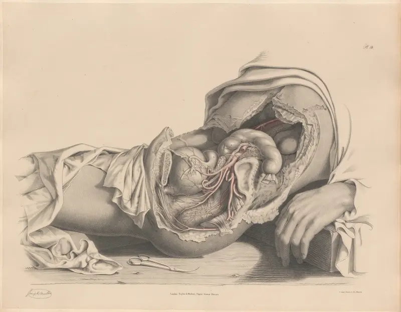 Die Arterien der weiblichen Beckenorgane von Joseph Maclise