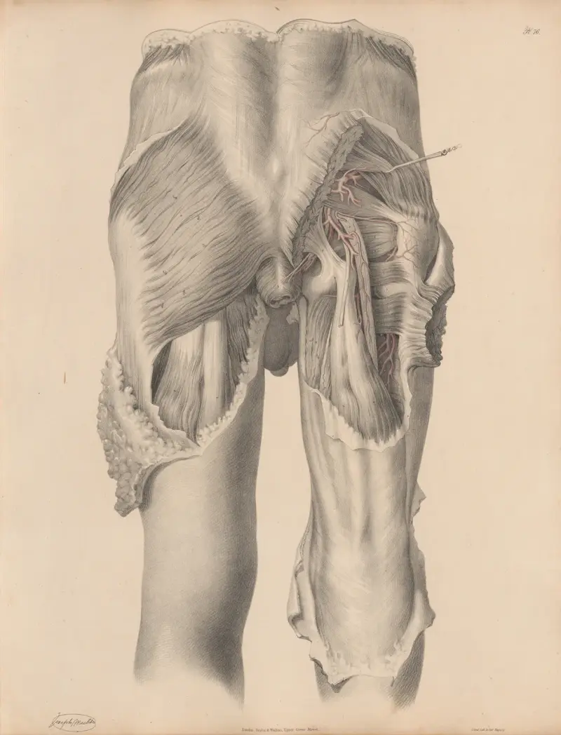 Artärerna på bäckenets baksida av Joseph Maclise