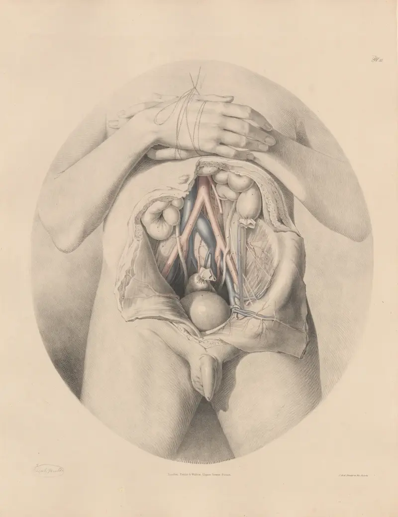Iliacaartärerna i förbindelse med venerna av Joseph Maclise