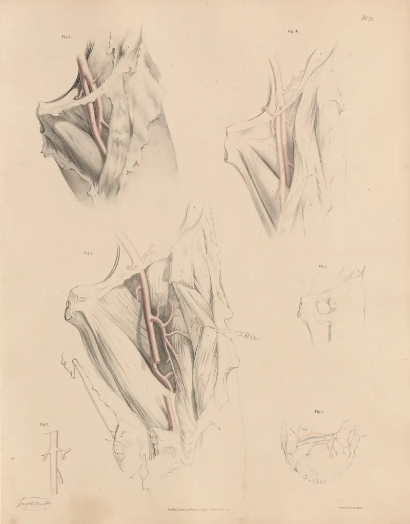 Olika former av den djupa lårartären av Joseph Maclise