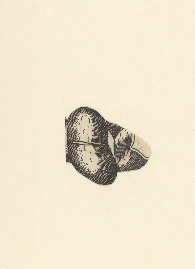 Kidney. – nr 2 av Lucas Kilian